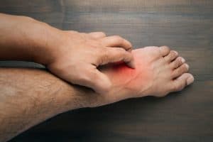 Man scratch the itch with hand: Itchy Legs When Running