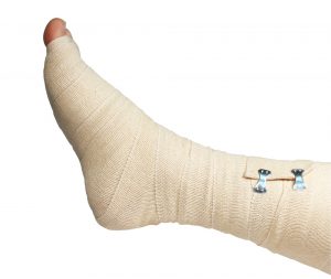 how to wrap foot for plantar fasciitis with ace bandage: ace bandage right foot